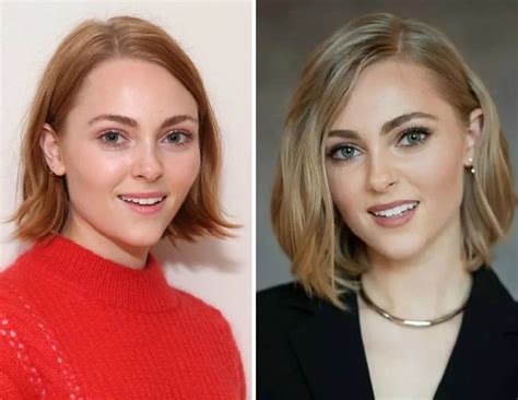Annasophia Robb Before And After Plastic Surgery