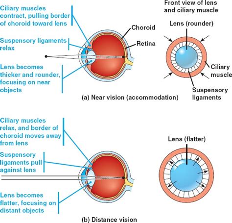 ¿por Qué Los Ojos Miopes Pueden Enfocarse En Objetos Cercanos Pero No