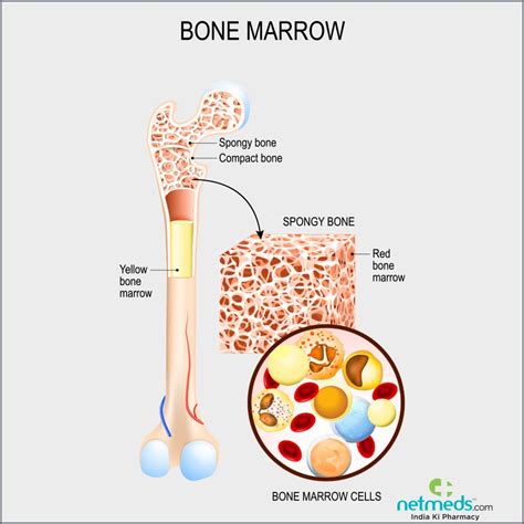 Bone Cancer Causes Symptoms And Treatment Netmeds