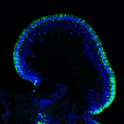 Retinal Organoid Scientists At Nihs National Eye Institut Flickr