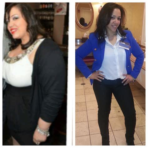 Heavy Girl To Healthy Girl A Journey With Gastric Bypass Surgery