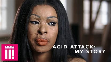 Acid Attack My Story 2018 Primewire