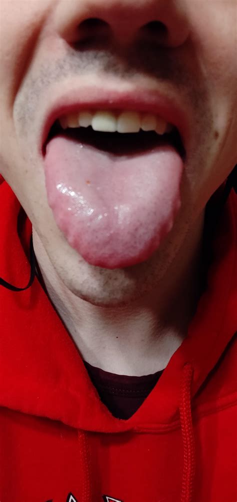 I just learned that this is called scalloped tongue and it doesn't ...