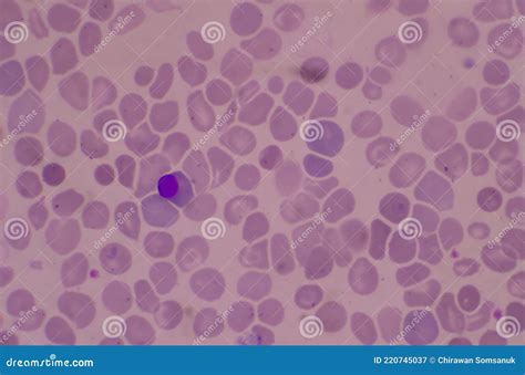 Nucleated Red Blood Cells Nrc In Blood Smear Stock Image Image Of