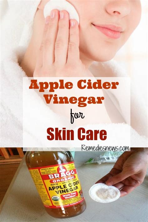 21 Amazing Apple Cider Vinegar Uses And Benefits Remediesnews