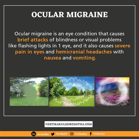 Flashing Lights In Eyes Ocular Migraine Shelly Lighting