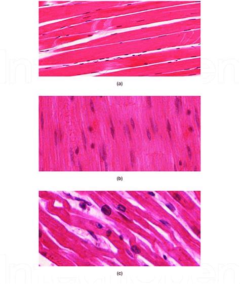 Types Of Muscle Tissue