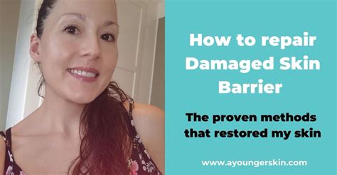Complete Guide To Skin Barrier Repair [restore Damaged Skin Lipid Barrier With These Proven