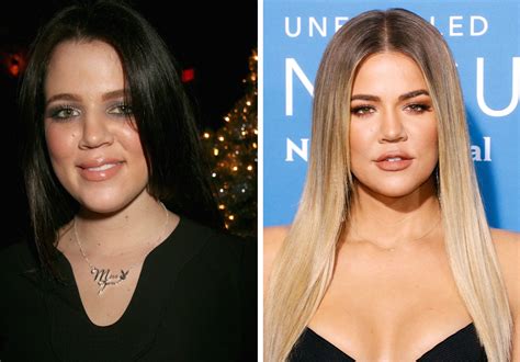 Kardashian Sisters Whos Gotten The Most Surgery