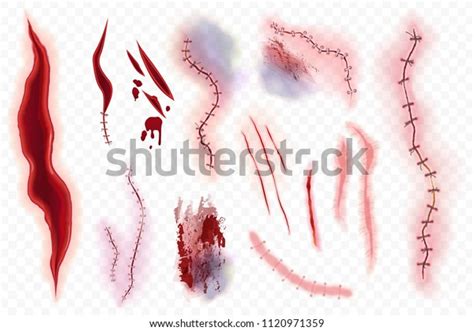 Realistic Vector Surgical Stitches Scars Bruise Stock Vector Royalty