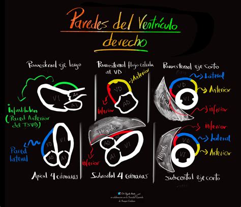 Paredes Del Ventrículo Derecho