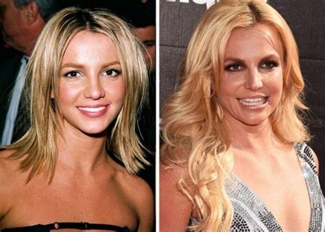 Britney Spears Plastic Surgery Inspiring Your Life