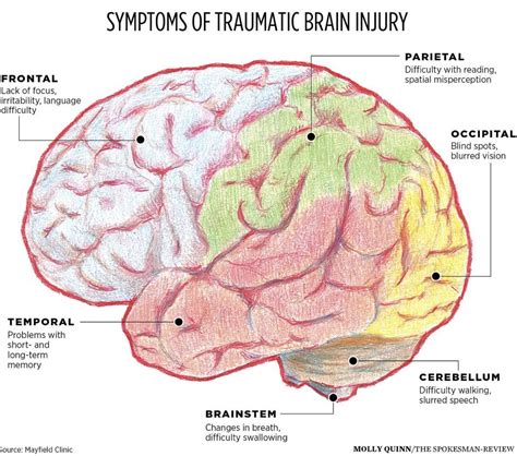 Traumatic Brain Injury Bbh Hospital Functional Medicine Better