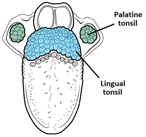 The Tonsils Waldeyers Ring Lingual Pharyngeal Palatine Tubal