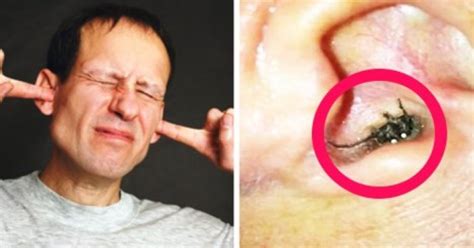 Man Discovers Something Horrifying In His Ear It Wasnt An Ear