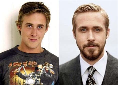 Ryan Gosling Nose Job Before And After Photos Celebrity Plastic Surgery Celebrity Plastic