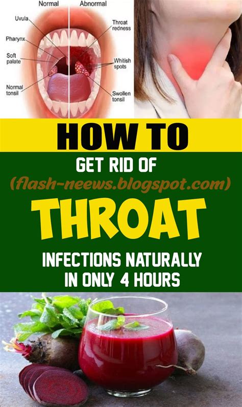 Instructions To Get Rid Of Throat Infections Naturally In Only Hours