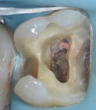 Ricostruttiva Prepotesica Su Dottori Nobile Dentisti Torino