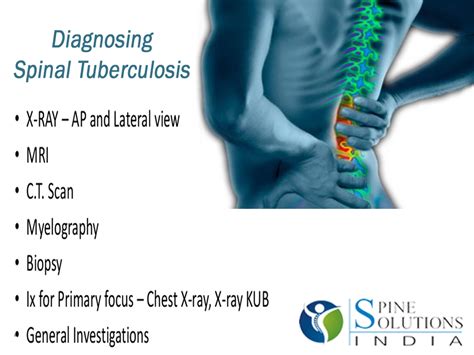 Spine Solutions India By Dr Sudeep Jain Diagnosing Spinal Tuberculosis