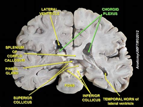 What Is The Function Of The Choroid Plexus — Brain Stuff