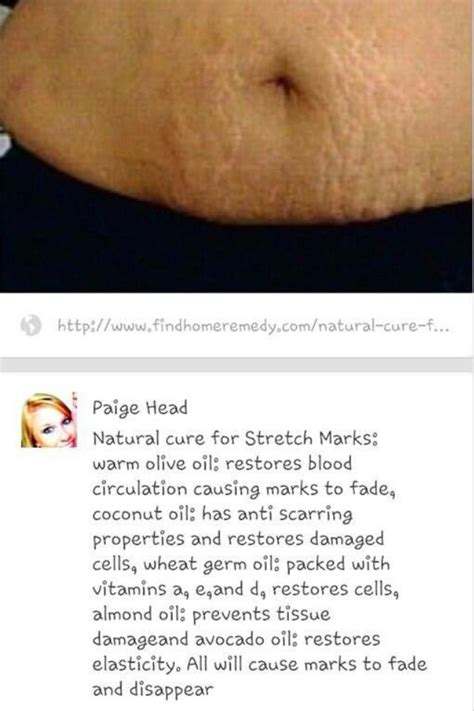 Fade Away Stretch Marks Diy By Yess S Musely
