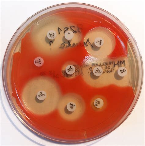 Serratia Marcescens Quip Labs