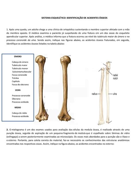 Exercício Acidentes ósseos SISTEMA ESQUELÉTICO IDENTIFICAÇÃO DE