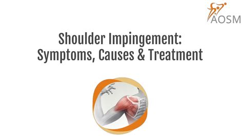 Ppt Shoulder Impingement Symptoms Causes And Treatment Powerpoint