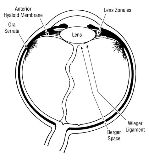 Surgically Induced Detachment Of The Anterior Hyaloid Membrane From The