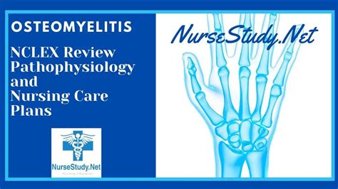 Osteomyelitis Nursing Interventions And Care Plans Nursestudynet