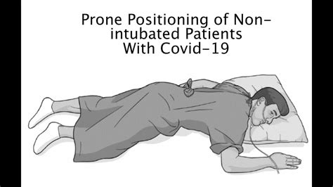 Prone Positioning Of Non Intubated Patients With Covid 19 YouTube