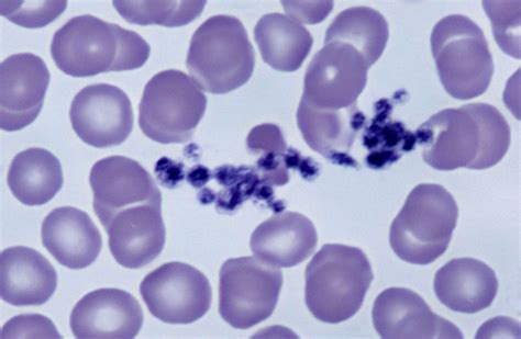 Thrombocytopenia In Dogs