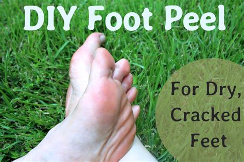 Home Remedies For Rough Dry Cracked Calloused Feet And Heels Bellatory