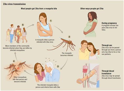 Zika Virus Disease Definition Description Demographics Causes And Symptoms