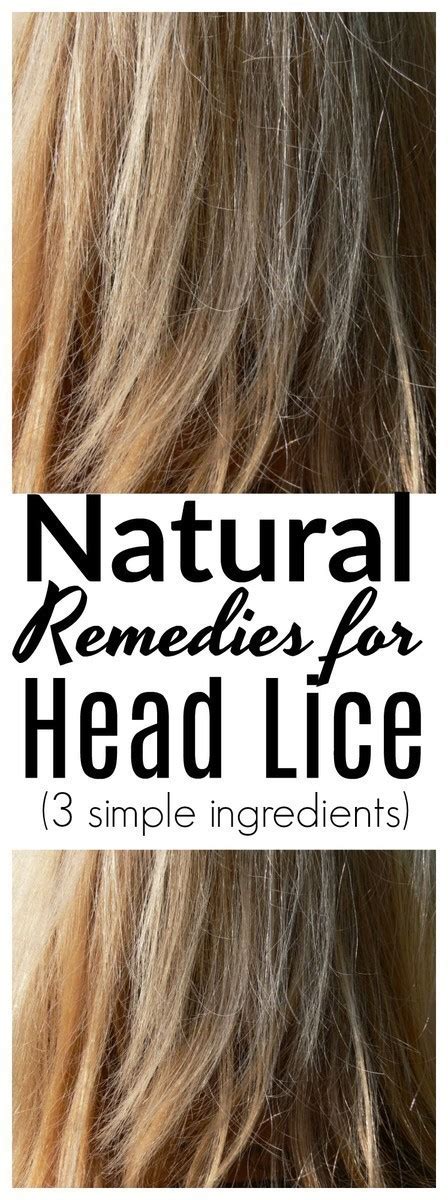 Natural Remedies For Head Lice The Centsable Shoppin