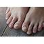 6 Causes Of Yellow Toenails And Treatments That Help  The Healthy