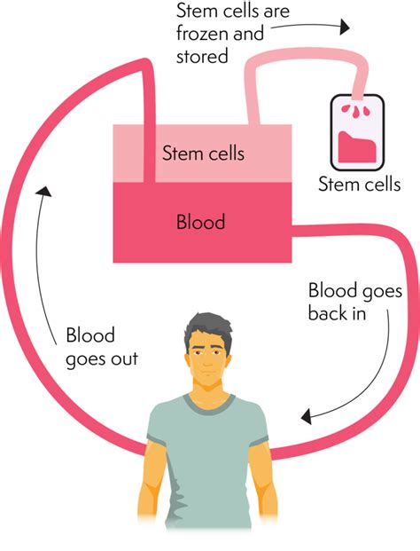 allogeneic stem cell transplant lymphoma australia