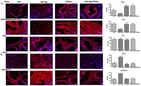 immunoreactivity of tumor suppressor genes a representative download scientific diagram