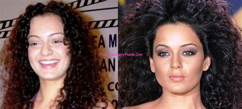 Kangana Ranaut Plastic Surgery Before And After Photos Botox Plastic