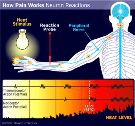 Physiology Of Pain Hubpages