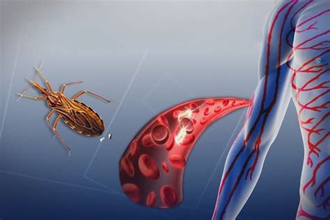 Doen A De Chagas O Que Causas Sintomas E Tratamentos Cannalize