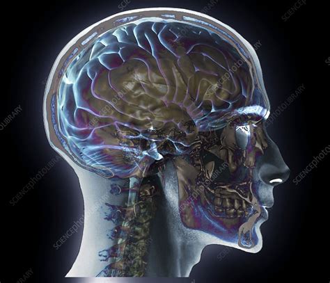 Normal Head And Neck Mri And 3d Ct Scans Stock Image C0166337