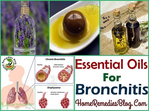 9 Essential Oils For Bronchitis Home Treatment Home Remedies Blog