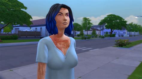 Mod The Sims Automatic Burn Scars Skin Detail Update 37