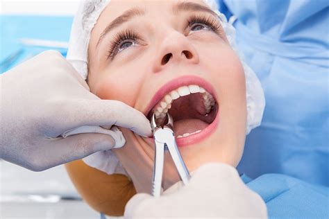 How Long Does It Take For Stitches To Dissolve In Mouth After Tooth Extraction Inspire Ideas 2022