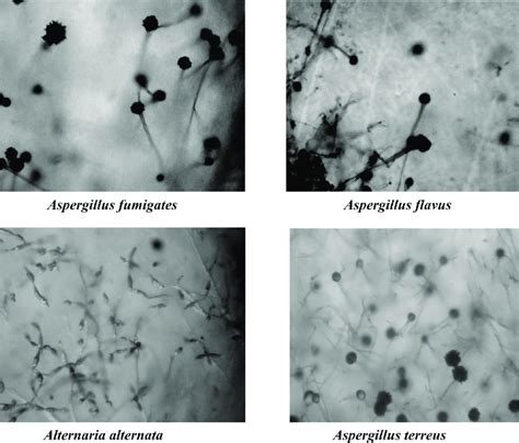 Microscopic Observation Of Selected Strains Of Fungi Under 40x High