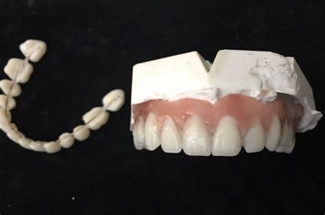 There are denture reline kits like densurefit or this one available online, and they are available in many drug stores and nationally known retail stores as well. DIY Denture Kit A2 Dental Impression Putty Cast Mold Upper ...