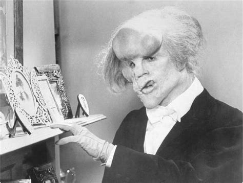 Two years later, merrick turns up at the hospital. Three men on a blog: FILM REVIEW: The Elephant Man (1980)