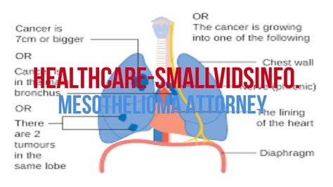 A mesothelioma is a rare form of cancer that affects the lungs, heart, stomach, and other organs. Mesothelioma Attorney | Attorney For Mesothelioma ...