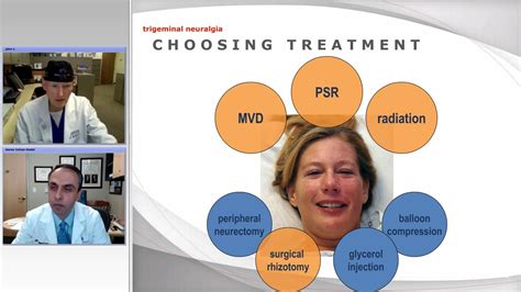 Percutaneous Procedures For Trigeminal Neuralgia Radiofrequency And
